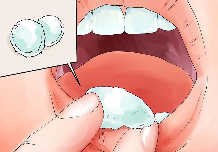 Лечение зуба народным средствами