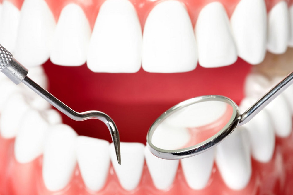 Причины кариеса на зубах