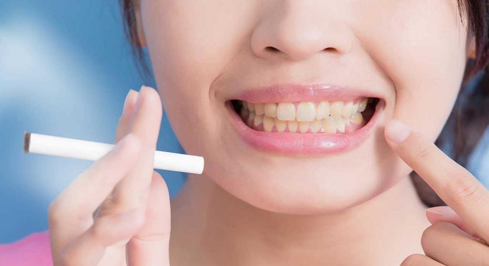 Почему желтеют зубы: причины и способы решения проблемы