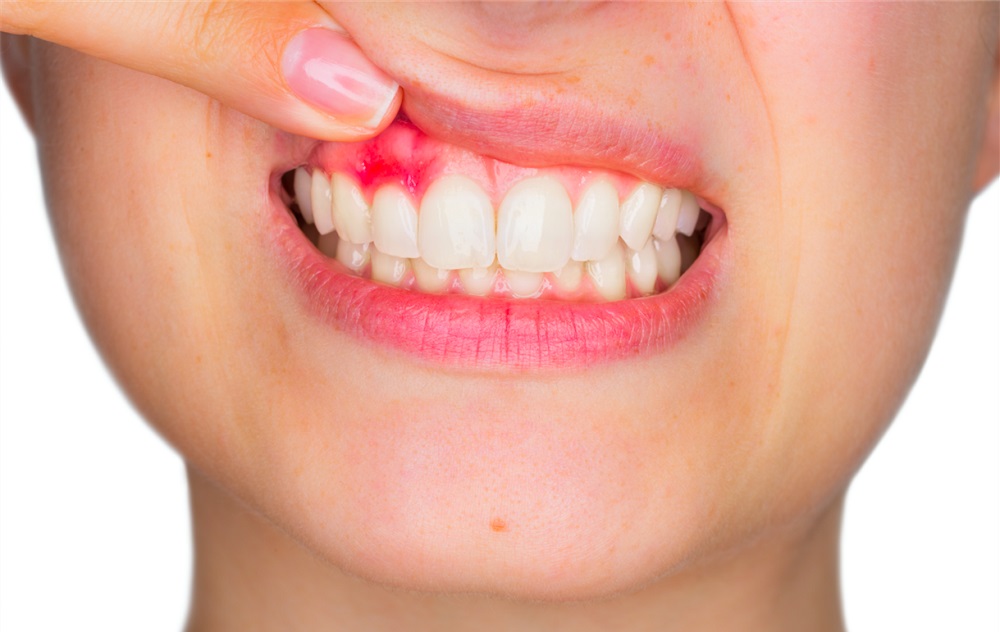 Болит основание зуба у десны thumbnail