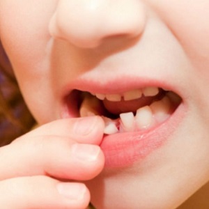 Лечение зубов во время простуды