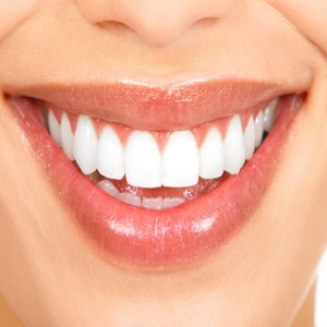 Истончение эмали и появление прозрачности зубов