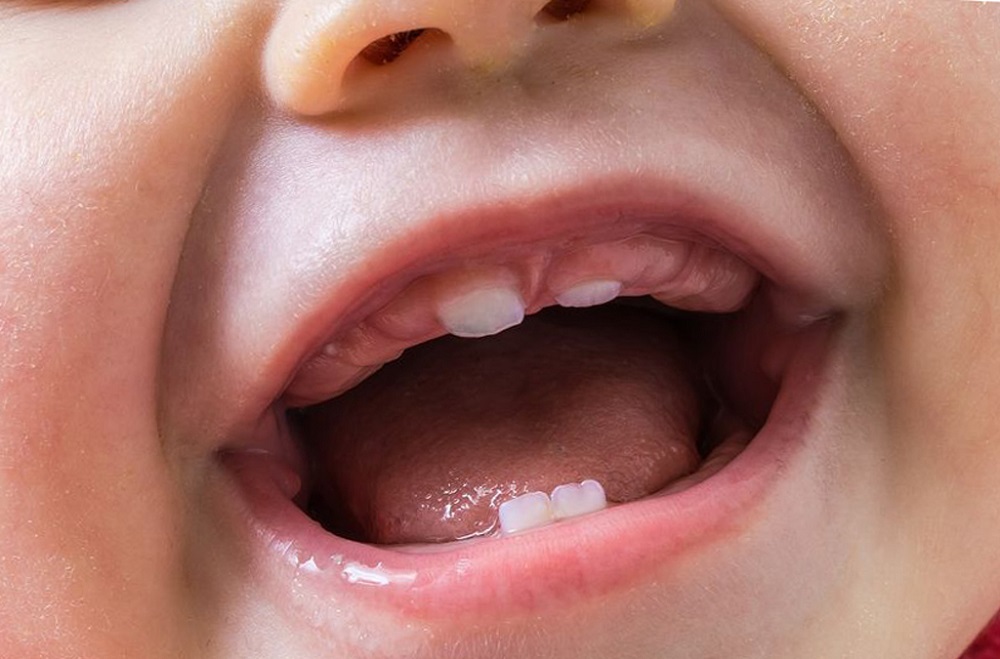 Режутся зубы у ребенка – какие зубы лезут первые