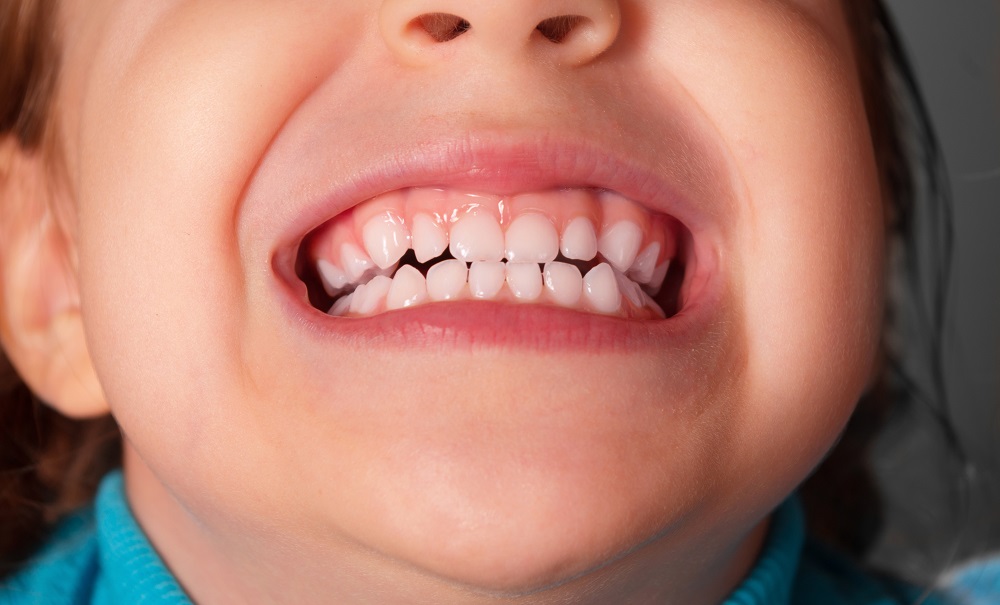 Ребенок скрежет зубами днем в 1 год 4 месяца