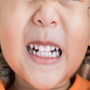 Ребенок скрипит зубами ночью во сне — патология или нет?