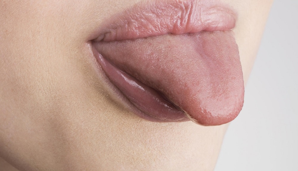 Почему опухает язык?