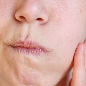 Что делать, если опухла щека? Причины, лечение, профилактика